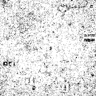 distribution of pathogenic agents